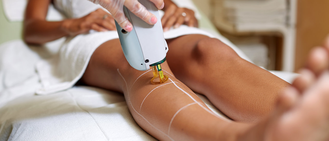 laser hair removal consultation questions