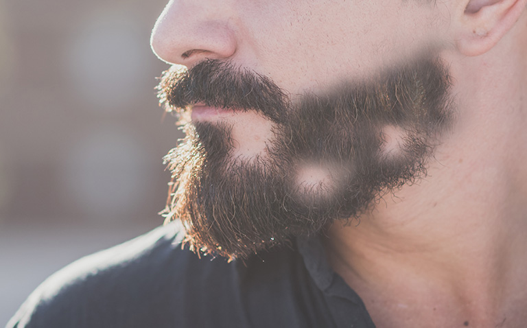 How to Make Your Beard Grow in Bald Spots