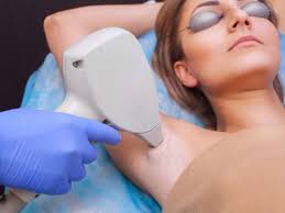What is Laser hair removal and how does it work?