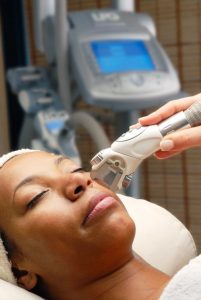 Laser hair removal for dark skin at home